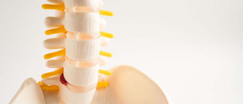 síntomas de hernia discal